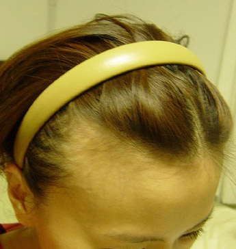 HAIR.jpg