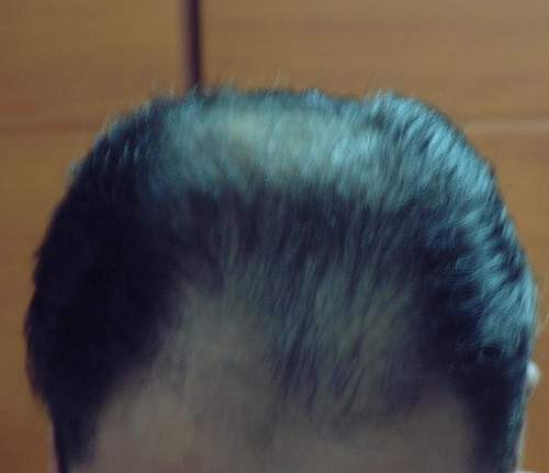 before.JPG