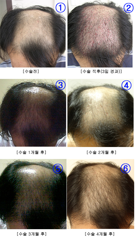 hair.jpg