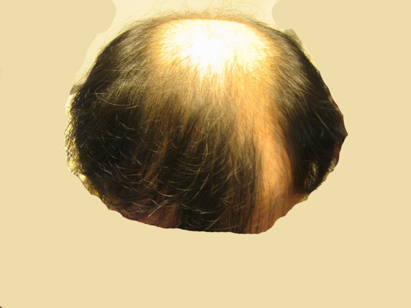 preOP-f2.jpg