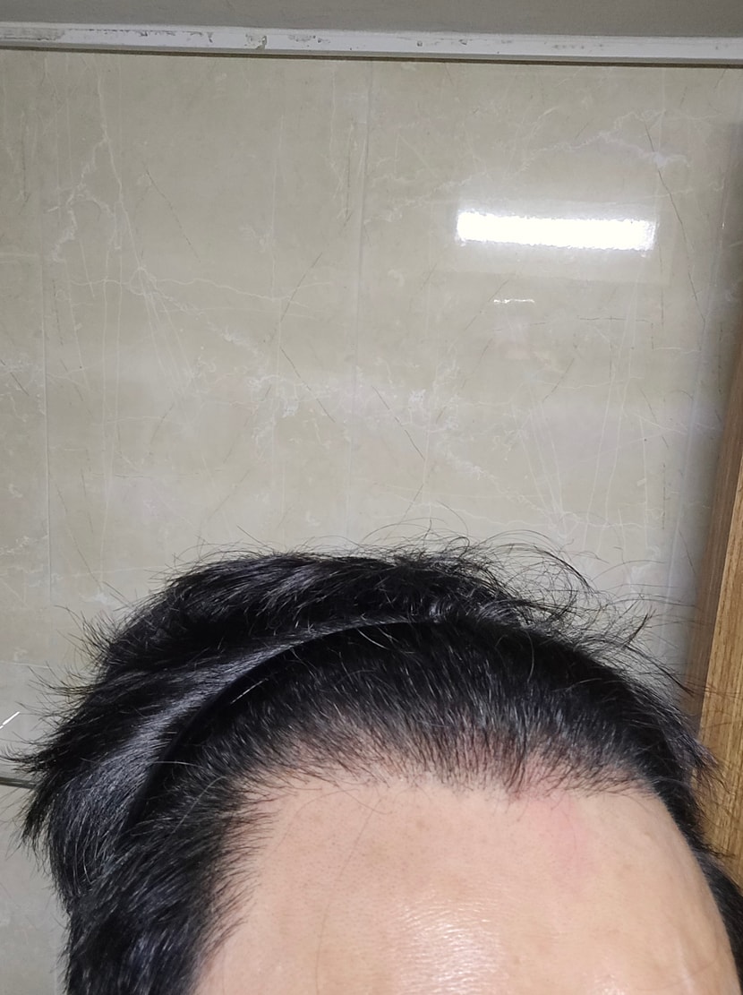 현재사진