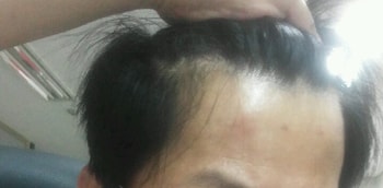 1년 10일 후 사진 M자