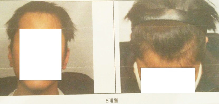 6개월