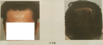 12개월