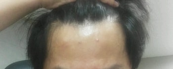 1년 10일 후 사진 정면
