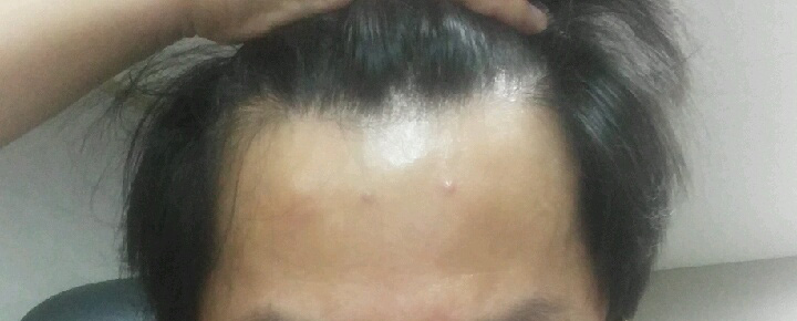 1년 10일 후 사진 정면