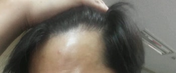 1년 10일 후 사진 M자
