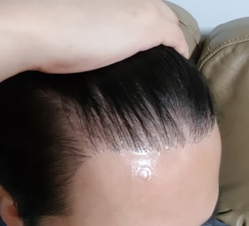 10개월차