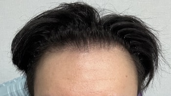 1년 6개월이 지난 현재 사진입니다