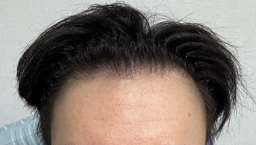1년 6개월이 지난 현재 사진입니다