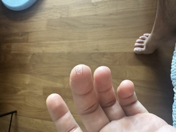 뽑혀나온 사진