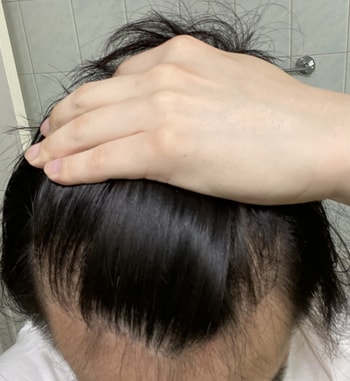 정면