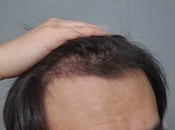 5개월차