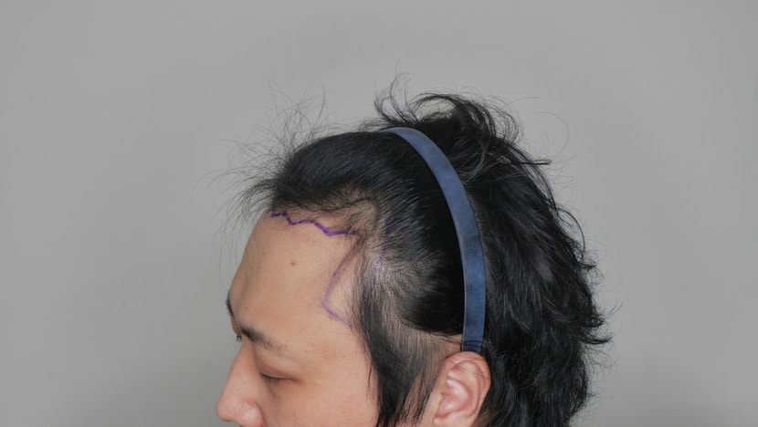 라인이 이상할뿐더러.. 이게 5천이라네