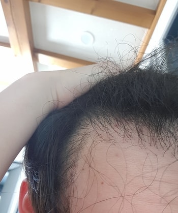정면, 옆