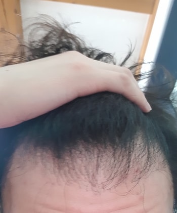 정면