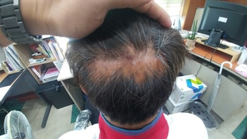 현재 사진입니다