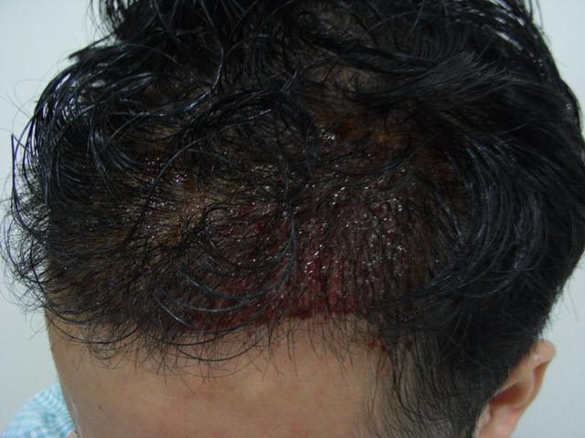 after.jpg