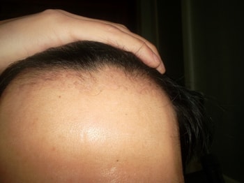 60일차        안습