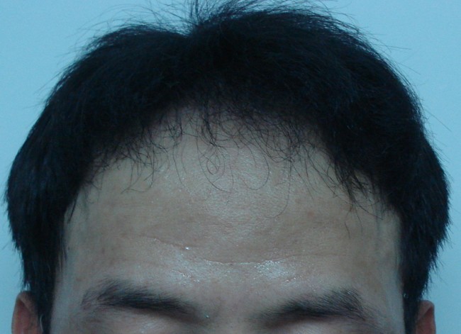 운동후.jpg