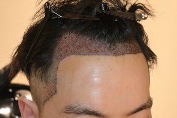 2일차