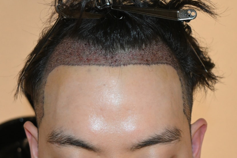2일차(정면)