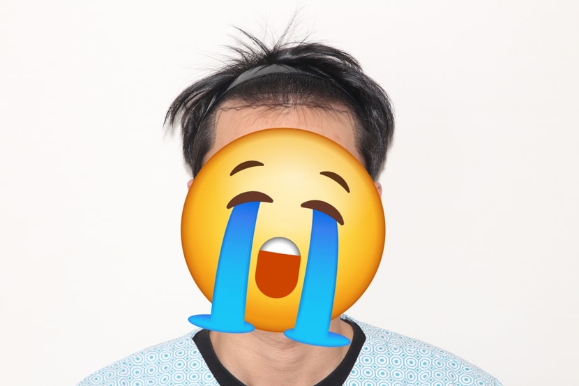 수술전