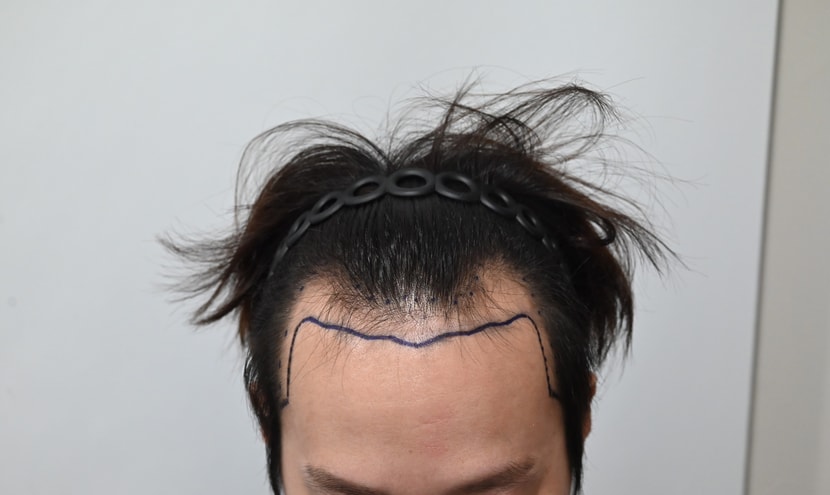 before