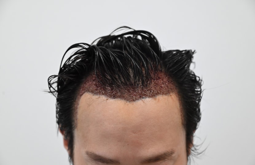 after