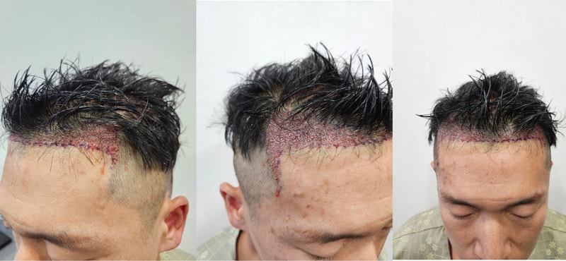 수술 후.jpg