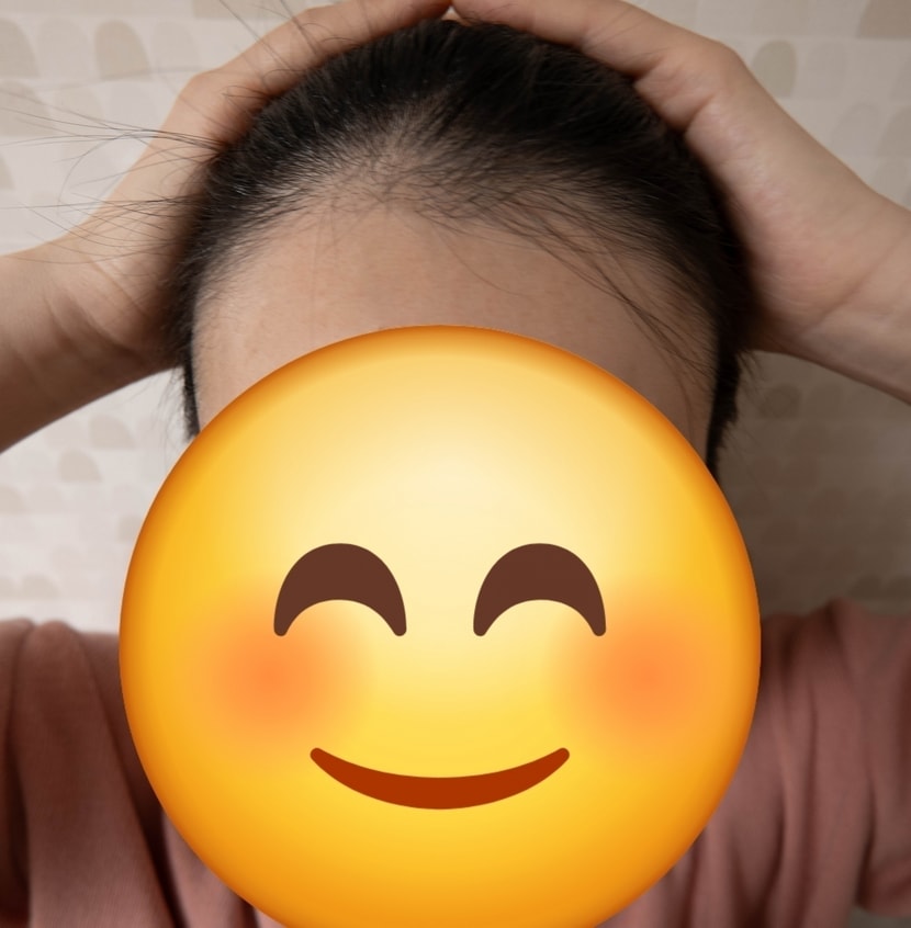 수술 전