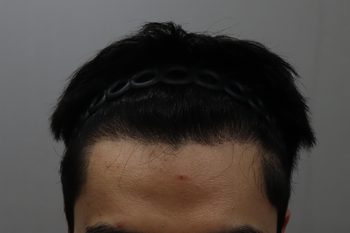 1년차