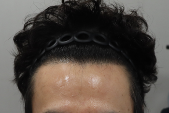 1년지난후