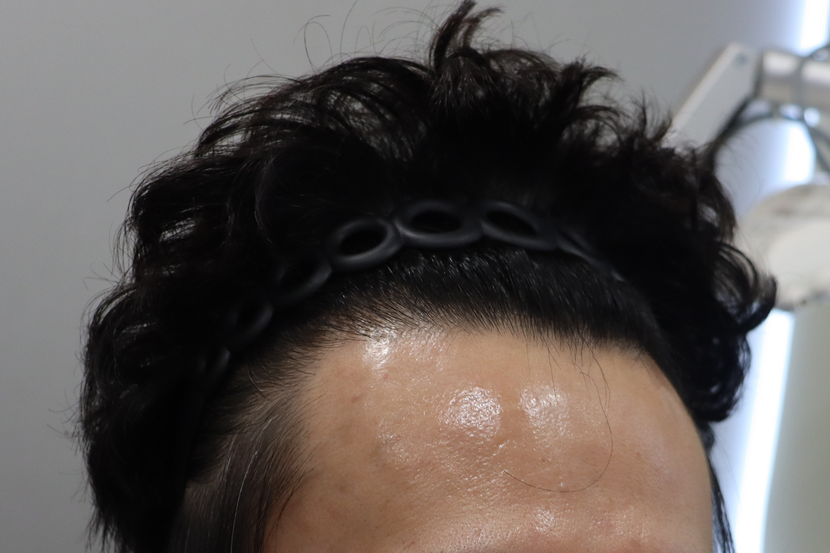 1년지난후