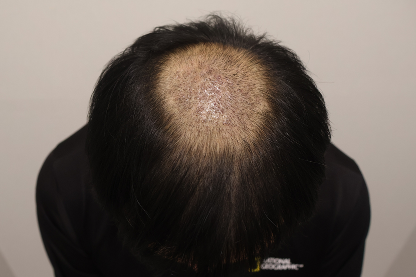 2주