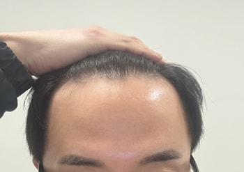 수술 전