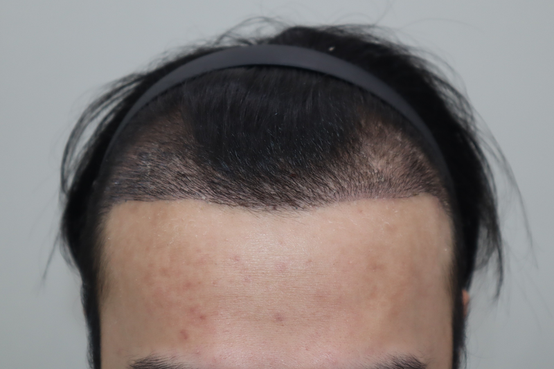 4.png