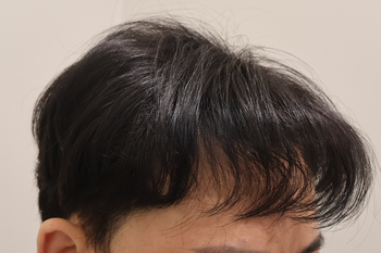 1년경과
