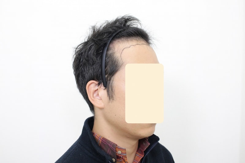 수술전3.jpg