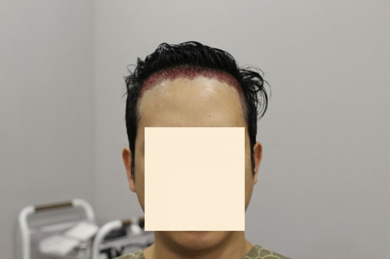 수술후1.jpg