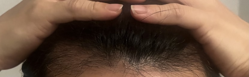 75일