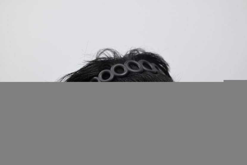 수술전