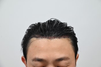 수술직후