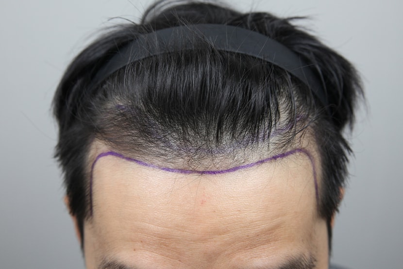 디자인