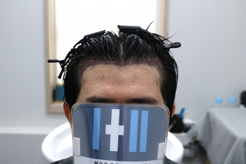 1000111584.jpg