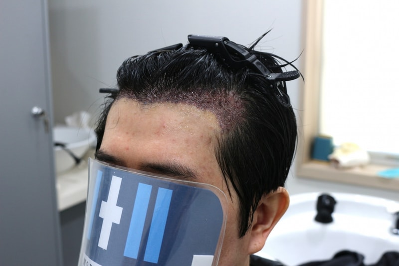 1000111586.jpg