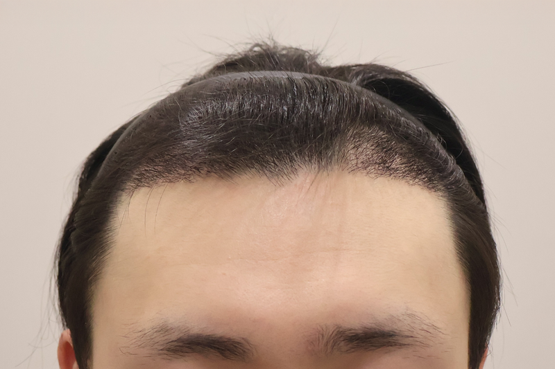 1.png