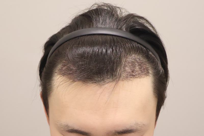 4.png