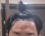 SCR-20260317-ohus.png