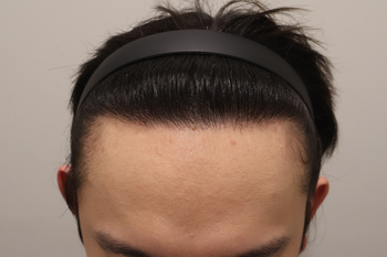 수술후